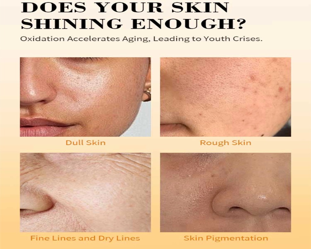 reduce dark spots reduce dark spots